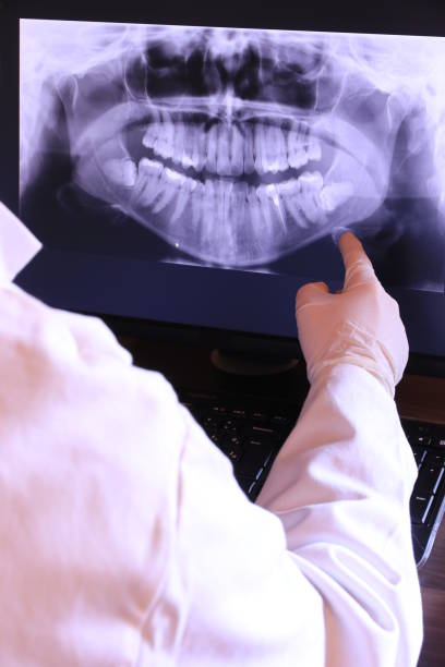 Best Emergency Tooth Extraction in Nikiski, AK
